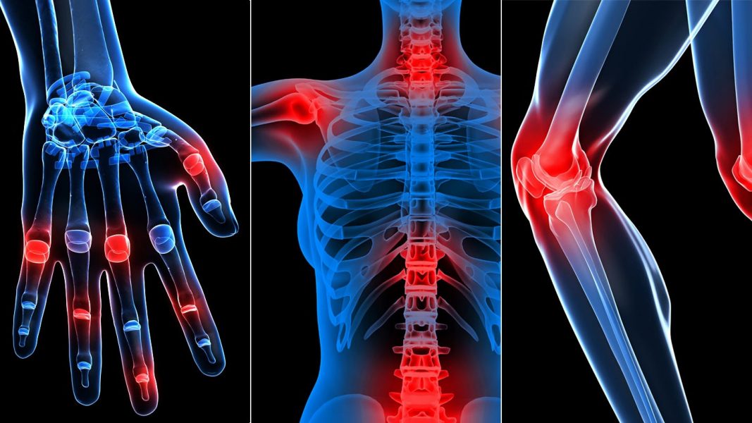 ízületi idegi betegségek a karok lábainak ízületei fáj a nyakat